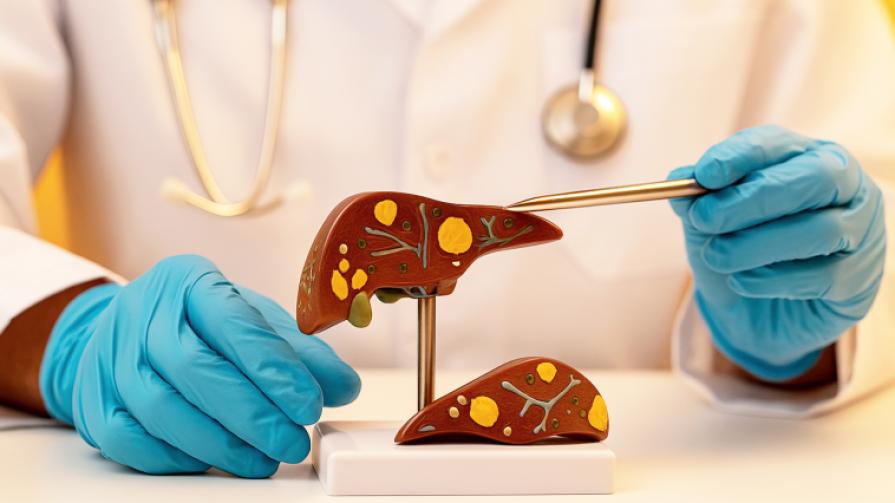 Sessiz İlerleyen Tehlike: Karaciğer Yağlanması